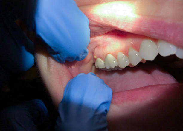 Best Emergency Dentist for Knocked-Out Tooth in Manteno, IL