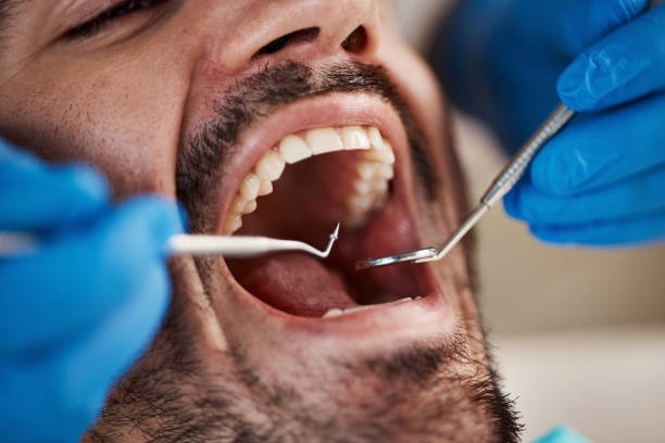 Best Emergency Dentist for Special Needs Patients in Manteno, IL